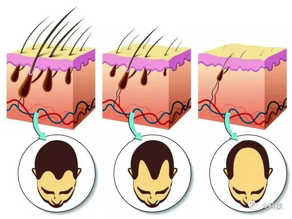 stage of hair growth