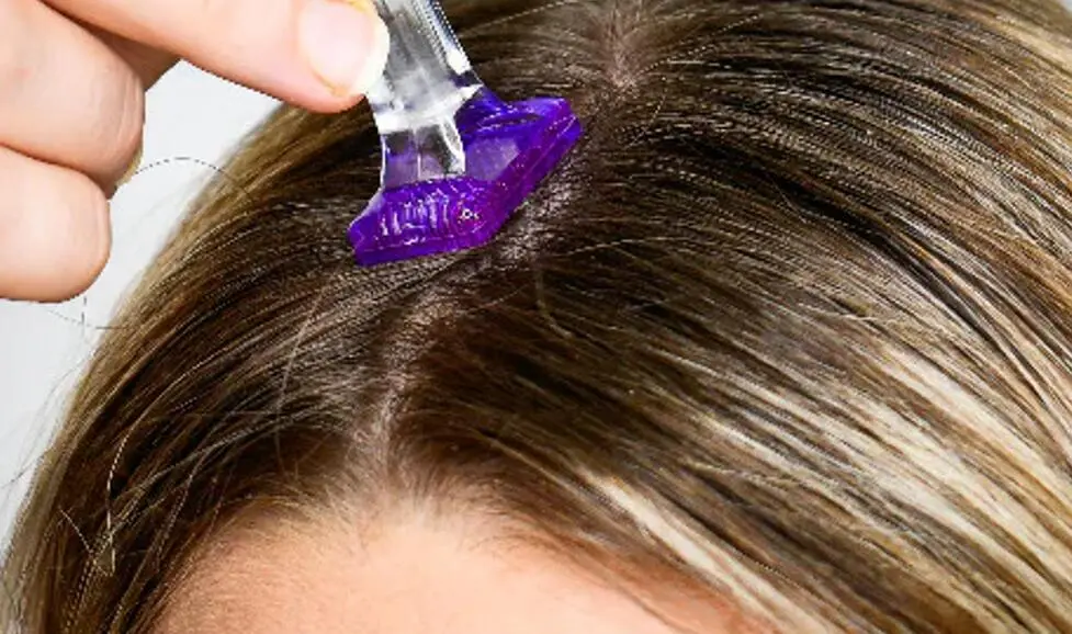 the frequency of derma stamping the scalp