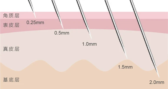 How to Choose The Right Derma Roller Needle Sizes