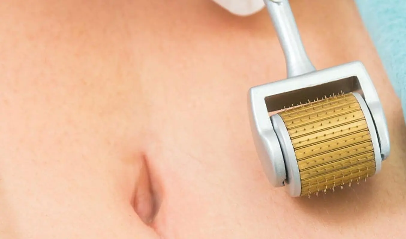 how to use derma roller on my stomach