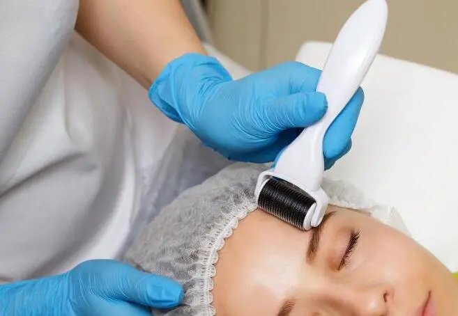 what is derma roller therapy