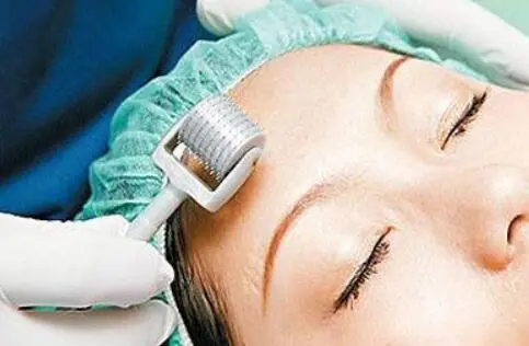 tips of using derma roller for face scars