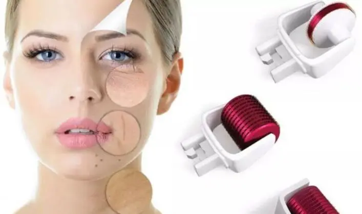 everything you need to know about derma roller for fine lines