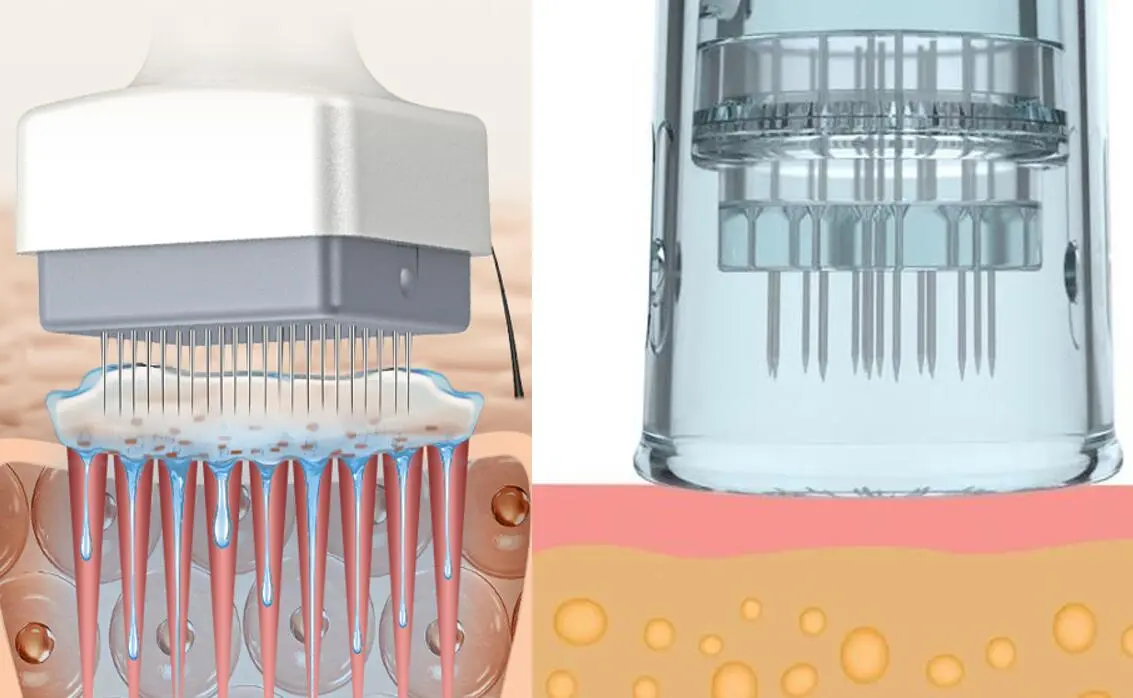 derma stamp vs derma pen