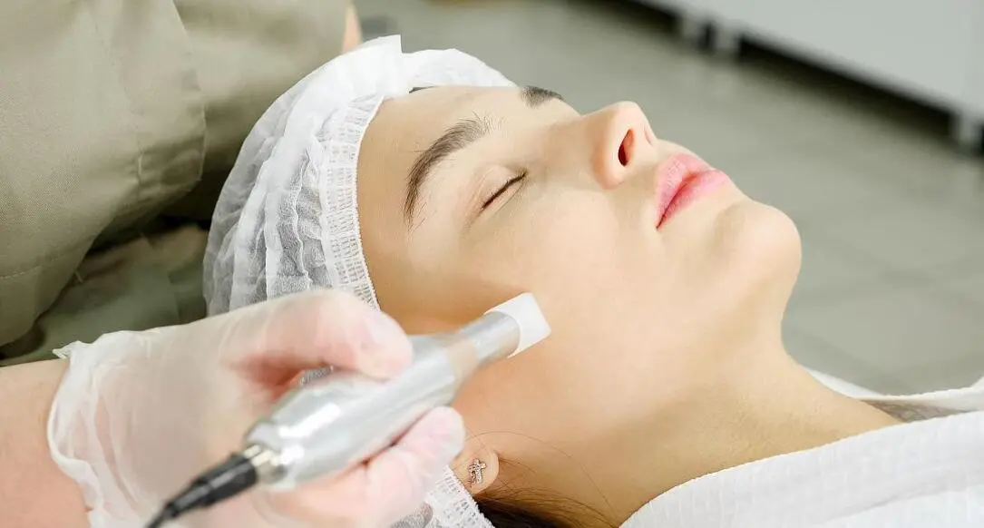 nano needling for facial treatment