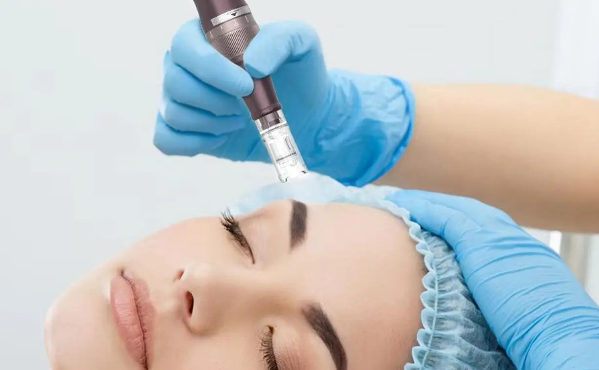 nanoneedling for fine lines treatment