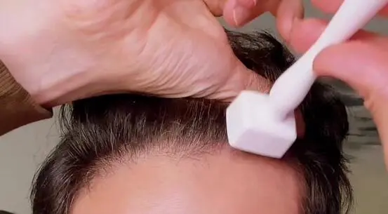 how often should you derma stamp your scalp